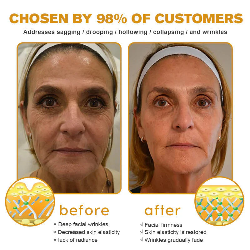 HOOMWELL™Botox Bee Venom Krem do usuwania zmarszczek