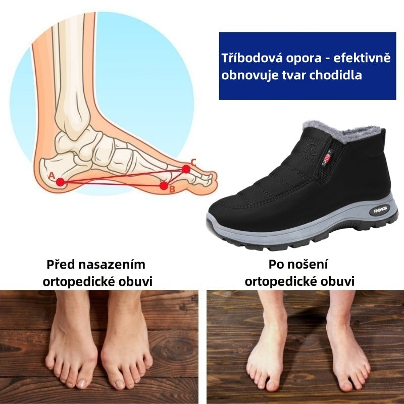 Ergonomiczne, zimowe buty ortopedyczne na ból stóp, kolan i pleców - Unisex