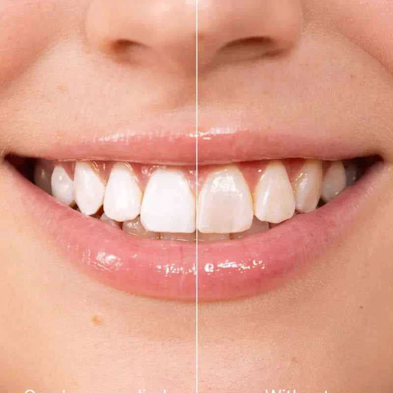 ✨ Zobna pasta za takojšnje beljenje zob — Rezultati so vidni takoj! Pakiranje 5 ml, dolg rok trajanja! 😁🦷