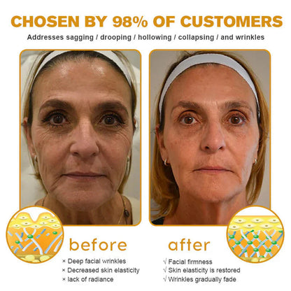 HOOMWELL™Botox Bee Venom Krem do usuwania zmarszczek