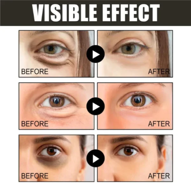 （🔥Kup 1, a 1 dostaniesz gratis🔥）Krem pod oczy z kofeiną