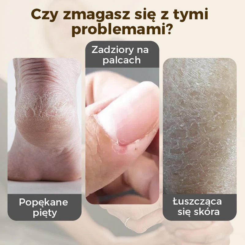 🎁💥Intensywnie regenerujący balsam do popękanych pięt i suchych dłoni