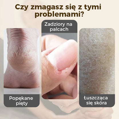 🎁💥Intensywnie regenerujący balsam do popękanych pięt i suchych dłoni
