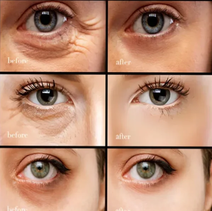 （🔥Kup 1, a 1 dostaniesz gratis🔥）Krem pod oczy z kofeiną